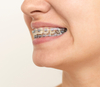 cabinet d'orthodontie du Dr Alain BREHAT