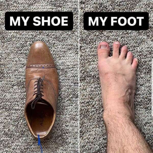 Le Pied postural, Suite !