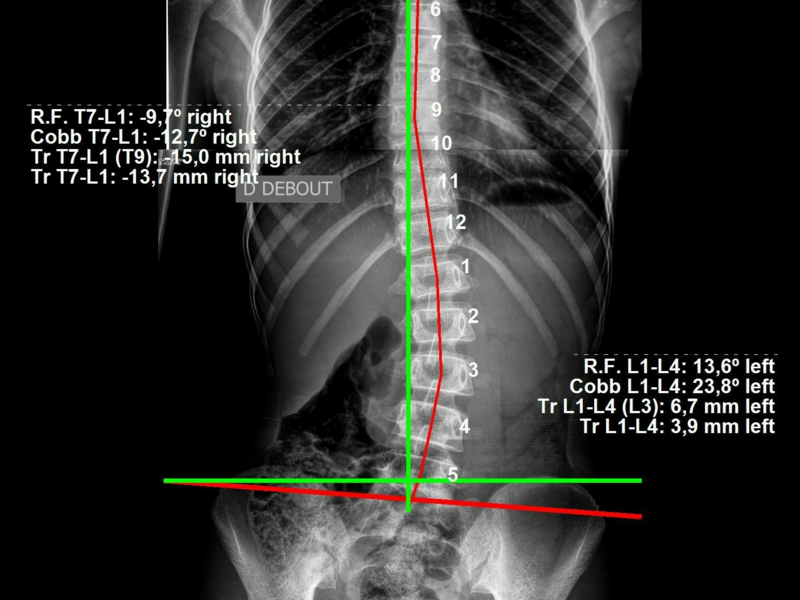 idermange_agatha_29_3_2024_er6463apu20240929-33210-1da5kcu