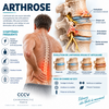 Illustration de l’arthrose de la colonne vertébrale avec usure discale et articulaire