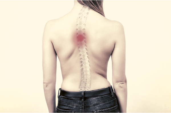 Scoliosis: The Diagnosis Has Been Made. Observation or Treatment?