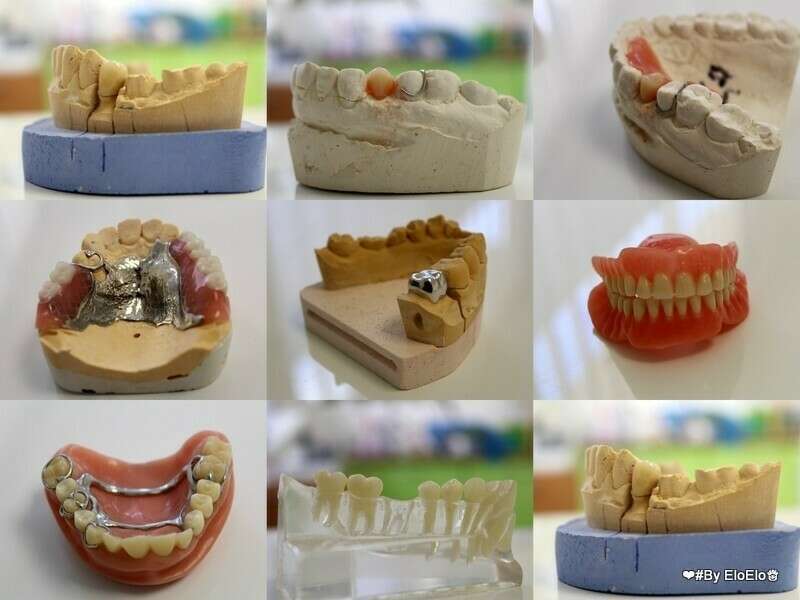 evzdbdixh0_1605536027