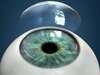 Laser thérapeutique chirurgie cornéenne cicatrice optique