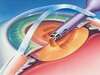 Chirurgie du glaucome