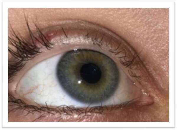 Les extensions de cils : beauté instantanée… mais à quel prix ?