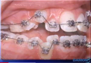 Présentation du système Damon