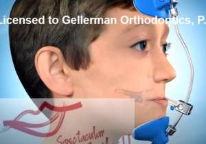 Le Masque de Delaire