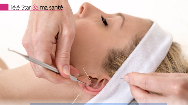 Mon ITW dans Télé Star : Auriculothérapie