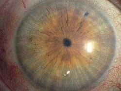 Myosis et système sanguin