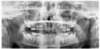 Image d'une radiologie dentaire