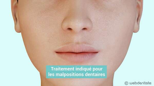 Traitement orthodontique - appareil autoligaturant en céramique