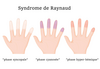 phases de la maladie de raynaud -etiopathie