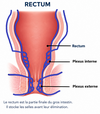 hémorroïdes interne et externe etiopathie