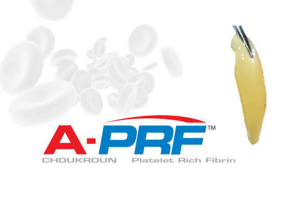 Régénération tissulaire guidée