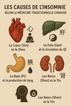 Les causes de l'insomnie