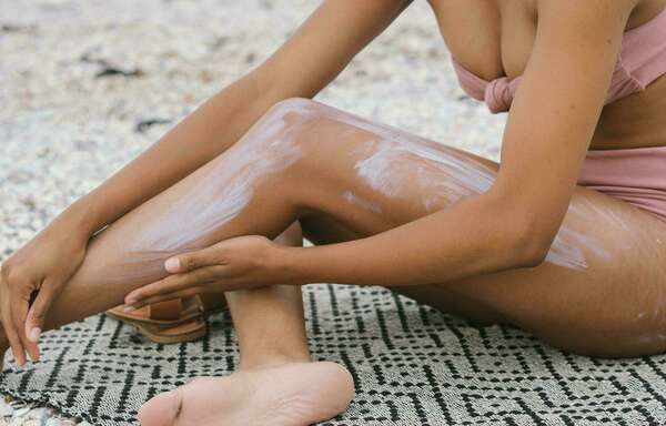 Astuces de Naturopathe contre les coups de soleil