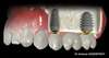implants cabinet dentaire bois guillaume