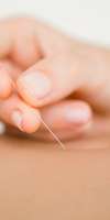 Mireille  Barnay , Acupuncture à Paris 15