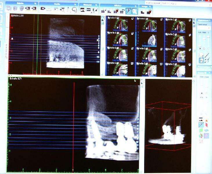 rwbonb4frq_1594820094