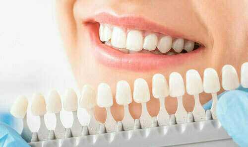 Les colorations dentaires