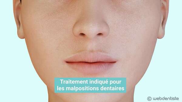 Traitement orthodontique - appareil multi-attache en céramique