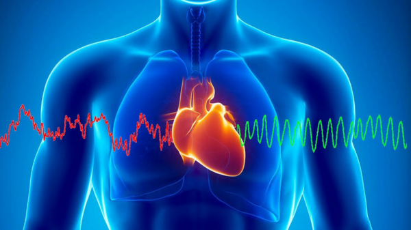 Cohérence cardiaque