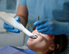 Scanner dentaire intra oral utilisé pour pose implants
