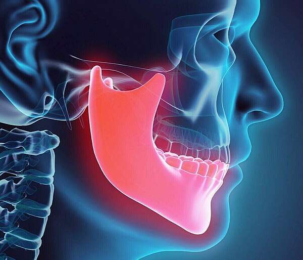 Dam et articulations temporo-mandibulaires (atm)