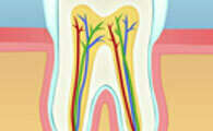 ENDODONTIE