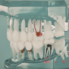 endodontie, Cabinet dentaire Paris 8