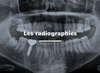 radiographie