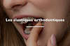 les élastiques orthodontiques