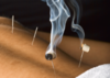 Moxibustion