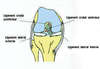 entorse genou