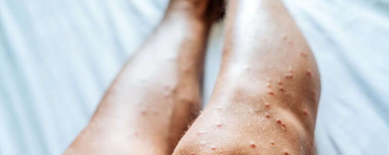 Comment identifier une infestation de punaises de lit ?