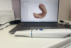 caméra digitale intra orale pour visualiser precisement les dents