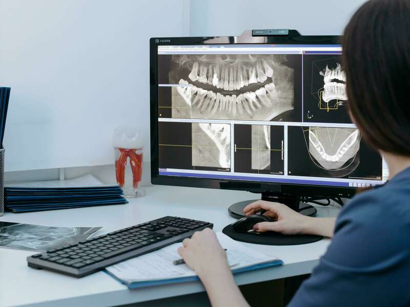 cone_beam_dentiste_femme_2_ecran