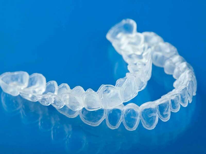 depositphotos_15850497_l