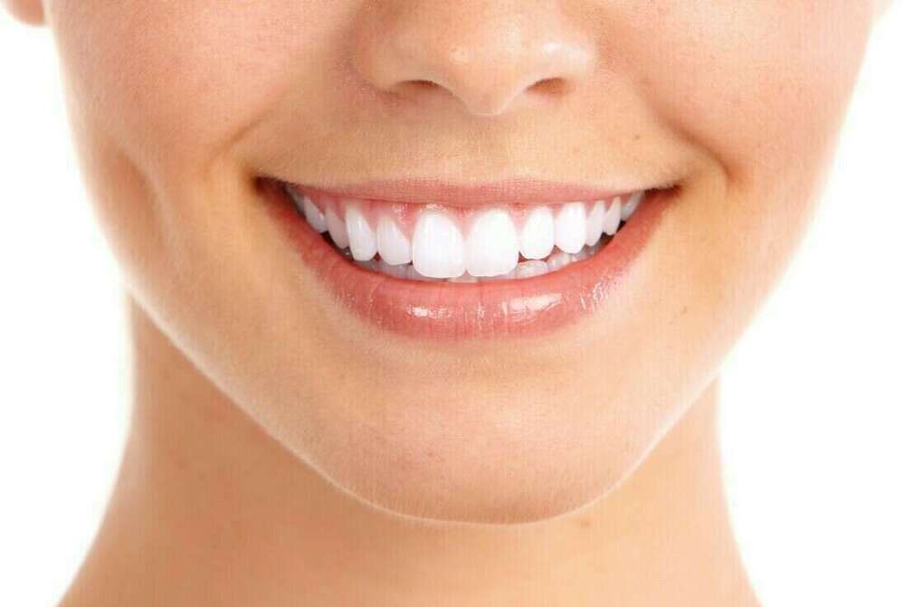 LE BLANCHIMENT DES DENTS "AU FAUTEUIL"