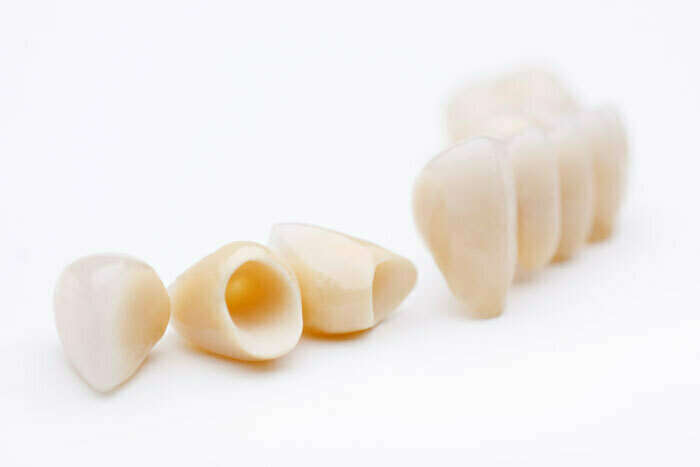 LA PROTHESE ZIRCONE