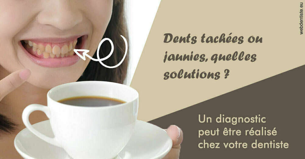 Dents tachées