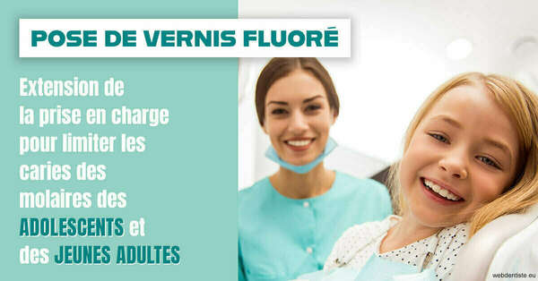 2024 t1 - pose vernis fluoré