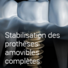Radiologie implant dentaire