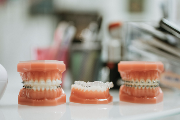 Bien réussir son traitement orthodontique 