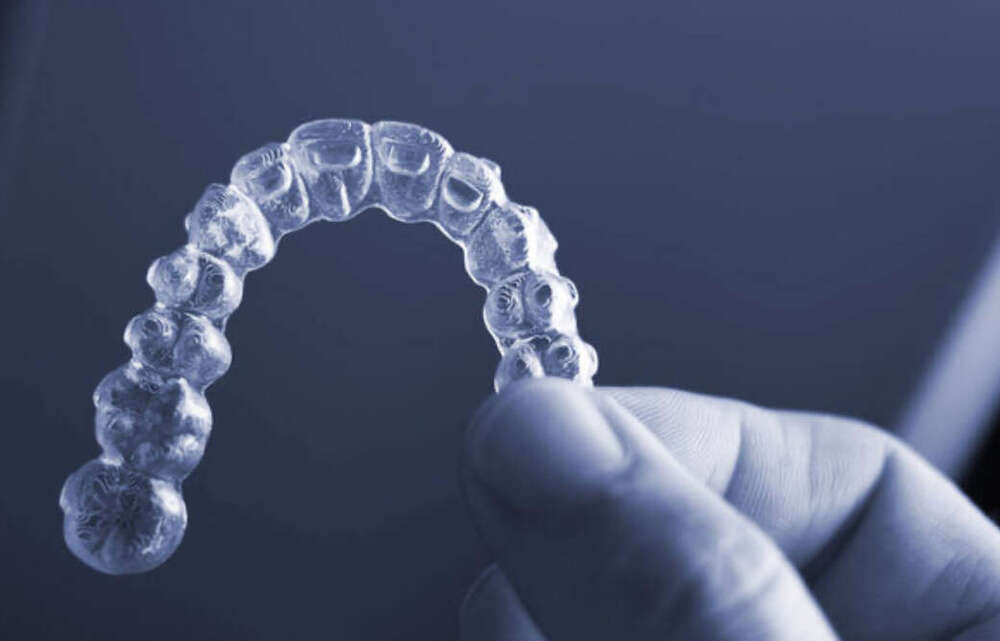 Gouttières d'alignement invisalign
