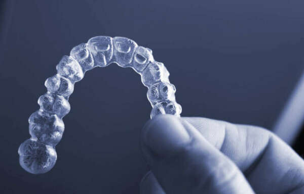Gouttières d'alignement invisalign