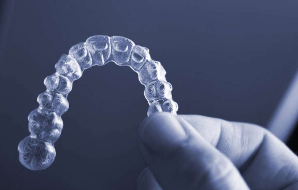Les avantages et les limites du traitement Invisalign® — free download