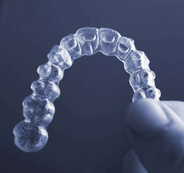 Gouttières d'alignement 