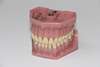 dents