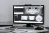 Équipements orthodontiques - Cabinet Chartres Dr LAIGNEAU et Dr RAFAITIN